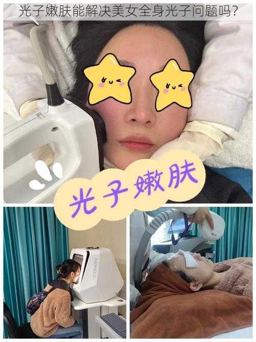 光子嫩肤能解决美女全身光子问题吗？